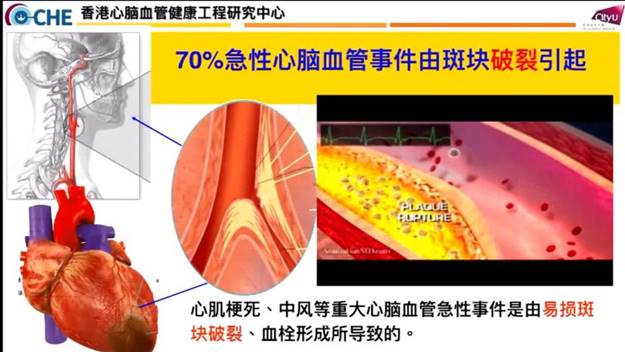 2022.11.21yl23455永利官网系列学术讲座-00_12_59-2022_11_21_16_24_48
